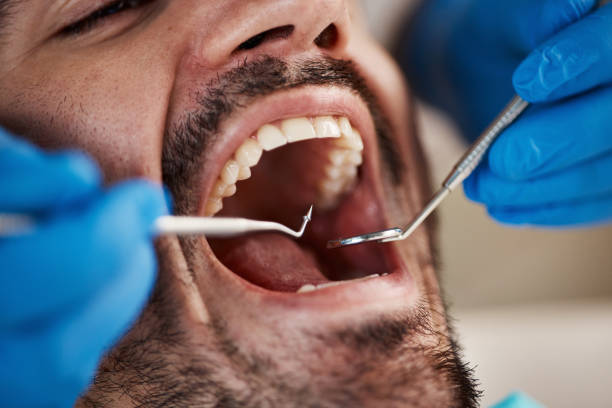 Best Emergency Tooth Extraction in Takoma Park, MD